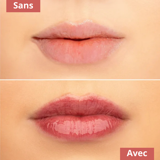 LumiLips™| Des lèvres belles, saines et pulpeuses.